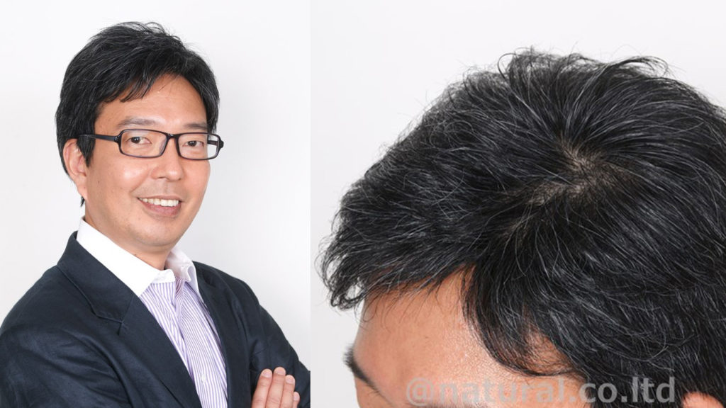 医療用ウィッグ男性　白髪入り10%