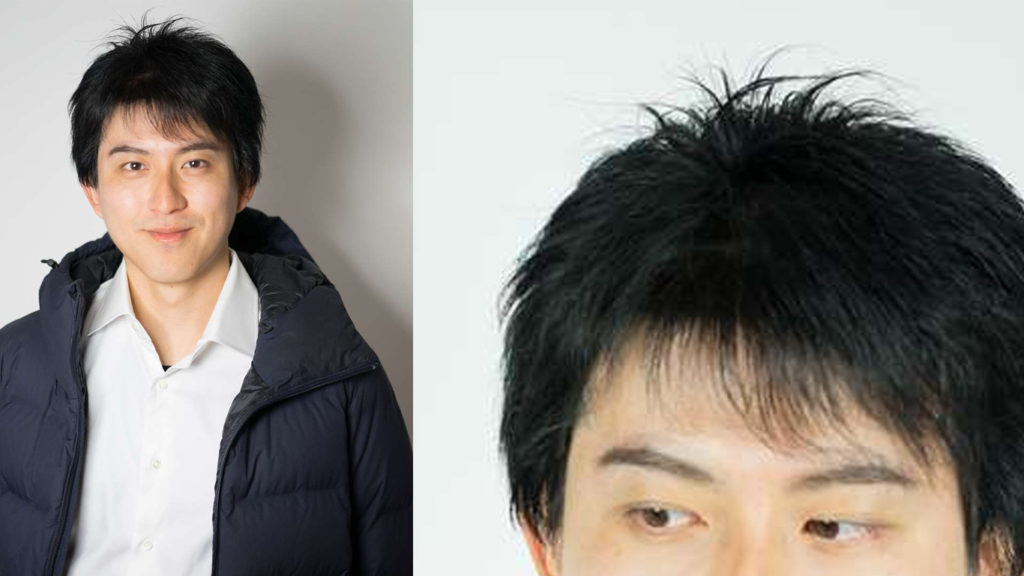 医療用ウィッグ男性　ナチュラルブラック