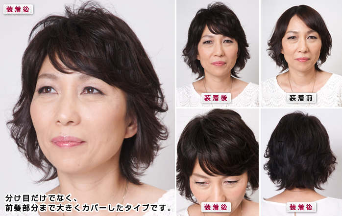 ヘアピースFシリーズ　装着写真