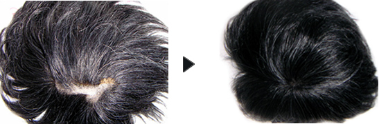 かつらの修理例