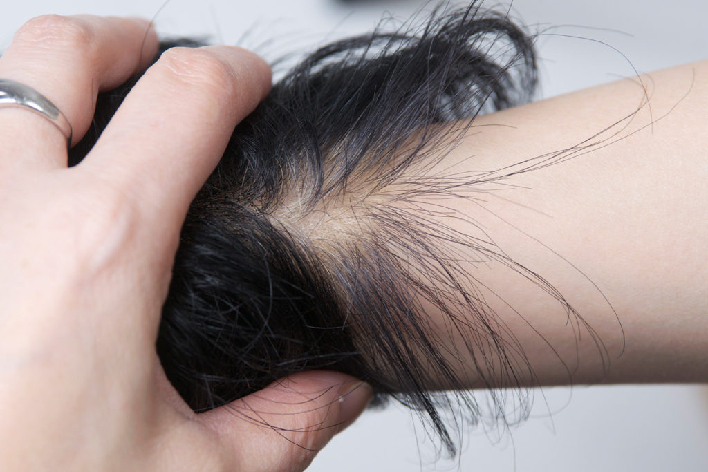 ウィッグの分け目写真